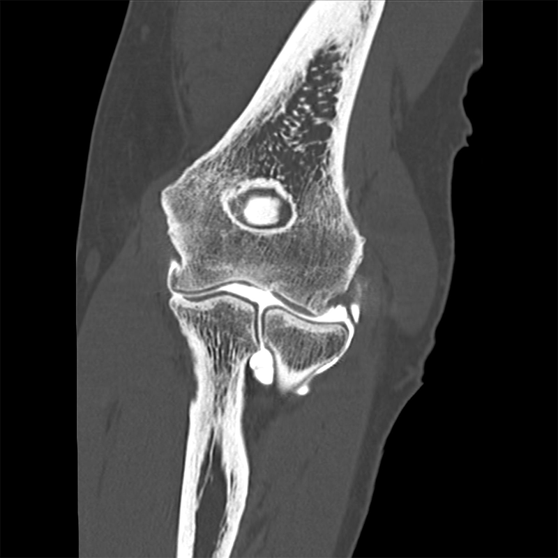 ARTHROSCANNER-ARTHROIRM - 25 radiologues à Clermont-Ferrand ...