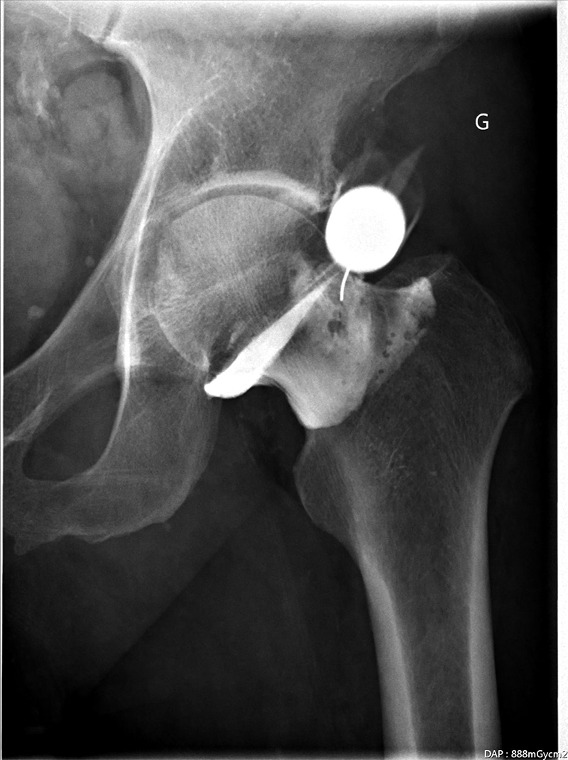 ARTHROSCANNER-ARTHROIRM - 25 radiologues à Clermont-Ferrand ...