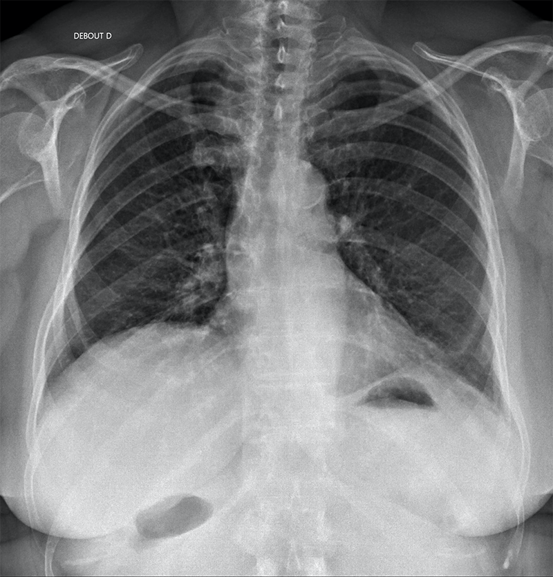 radiographie-standard